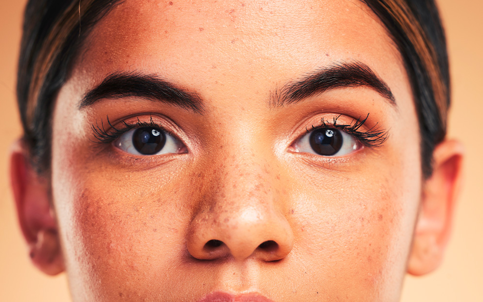 Conteúdo lista Dermatologia