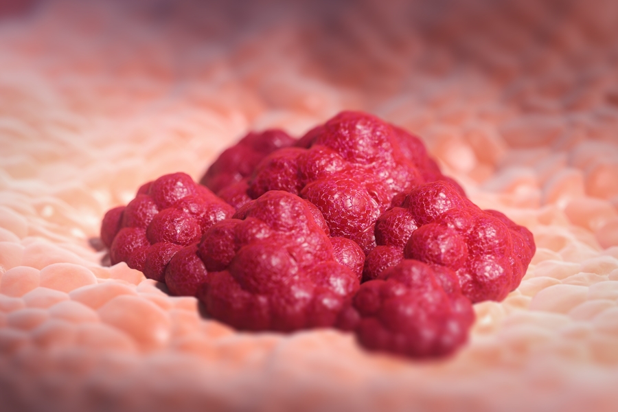 Conteúdo lista Oncologia e Hematologia