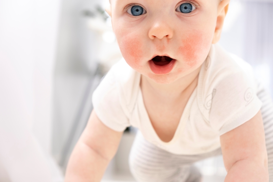 Conteúdo lista Dermatologia